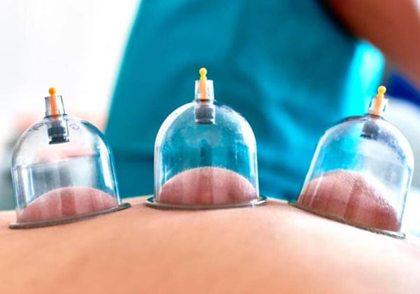 hijama